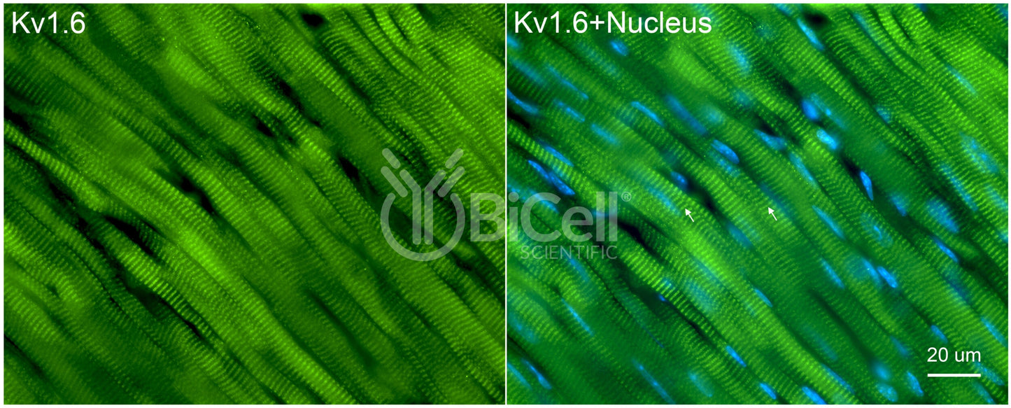 KCNA6 (Kv1.6) Antibody - Western Blot Validated