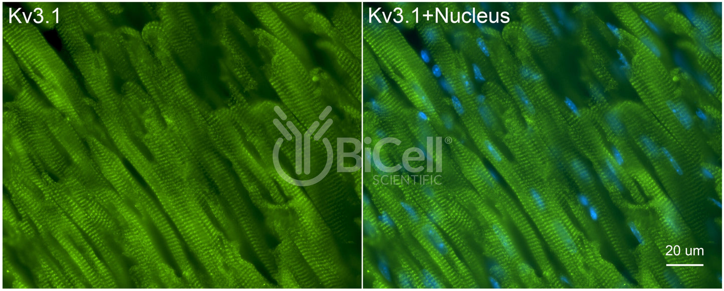 KCNC1 (Kv3.1) Antibody - Western Blot Validated