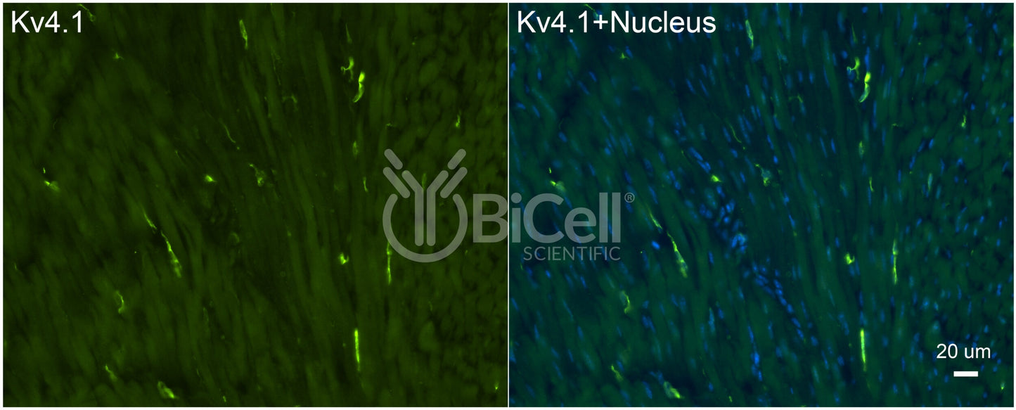 KCND1 (Kv4.1) Antibody - Western Blot Validated