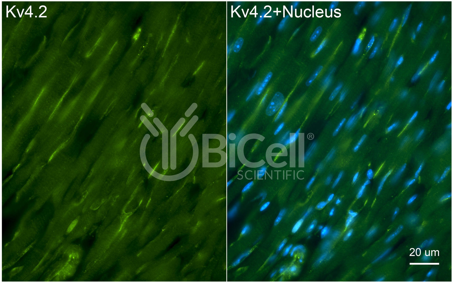 KCND2 (Kv4.2) Antibody - Western Blot Validated