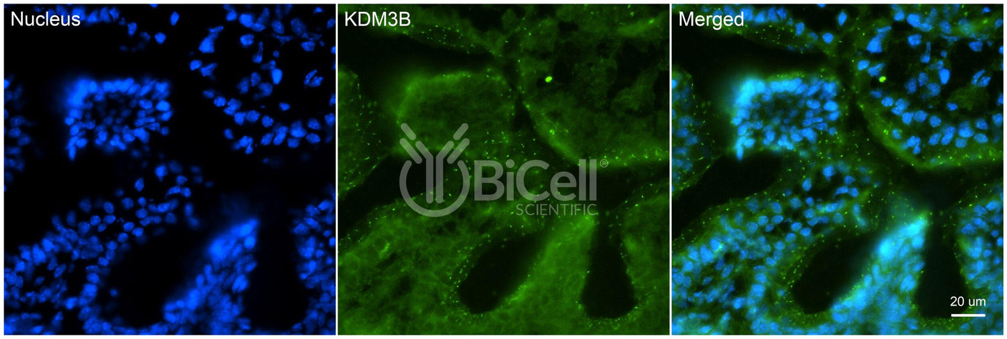 KDM3B Antibody