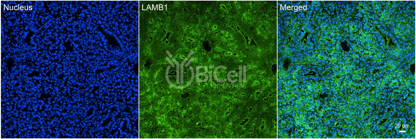 Laminin beta-1 (LAMB1) HiRe Antibody - Western Blot Validated
