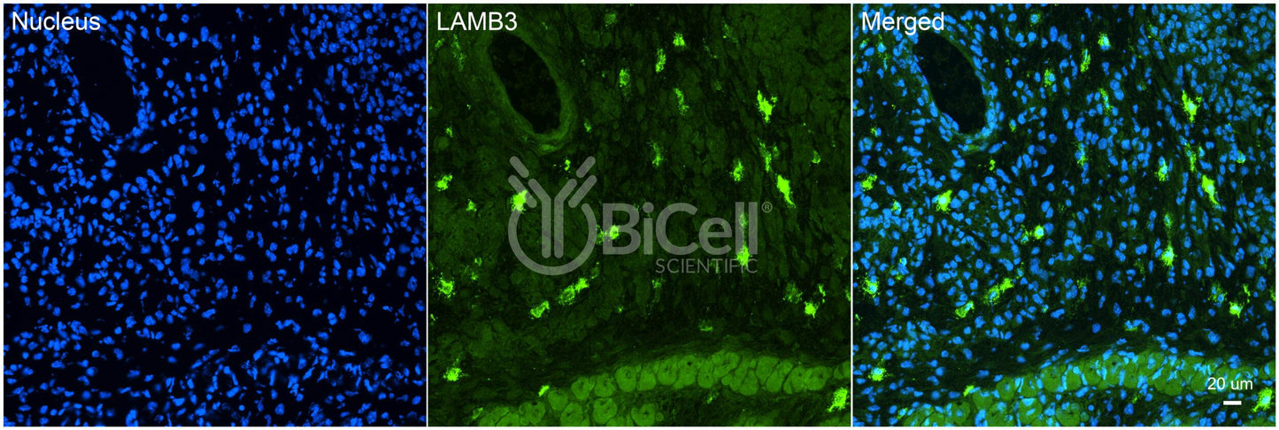 Laminin beta-3 (LAMB3) HiRe Antibody - FFPE Validated