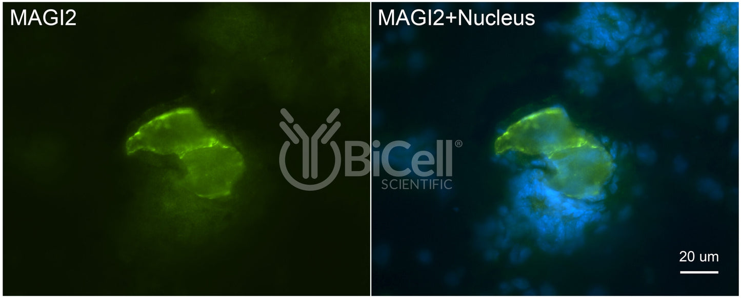 MAGI2 (AIP1 or NPHS15) Antibody - Western Blot Validated