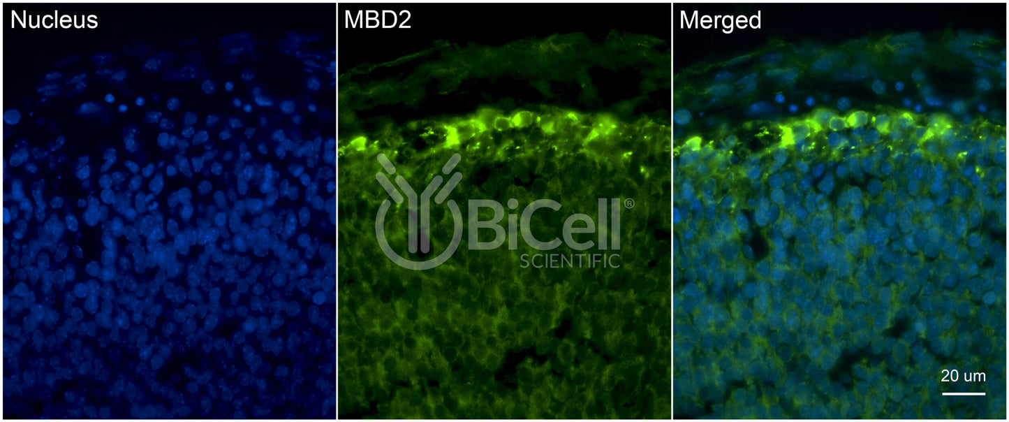 MBD2 (DMTase) Antibody - FFPE Validated
