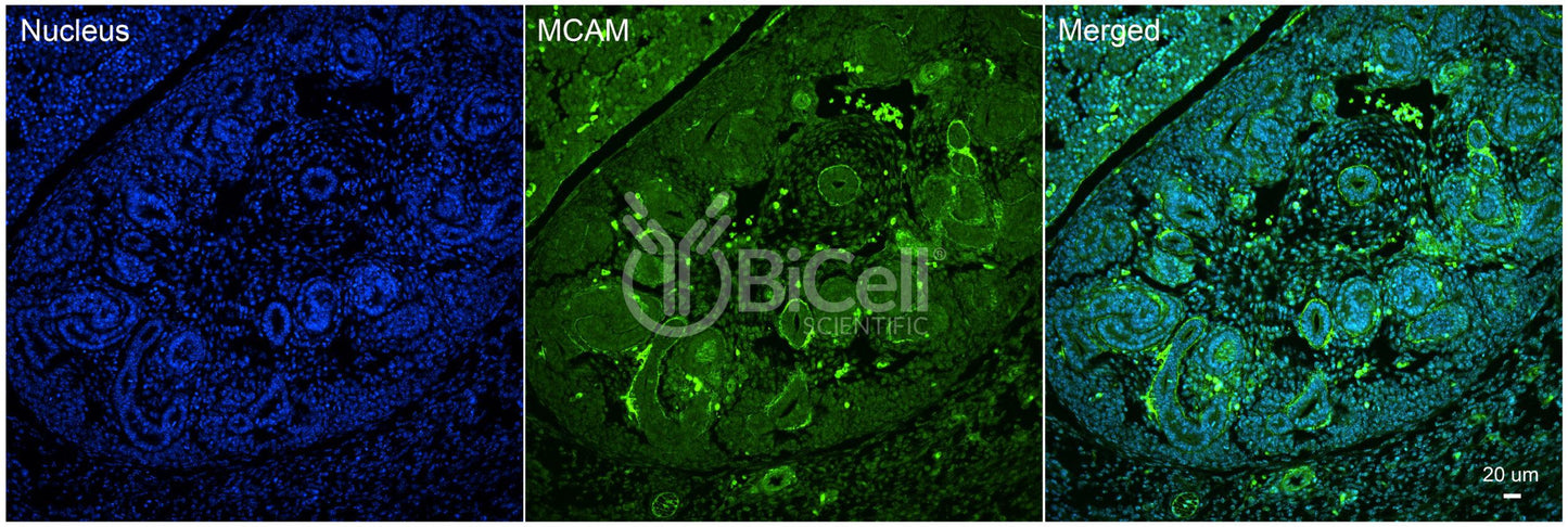 MCAM (CD146 or MUC18) Antibody - Western Blot Validated