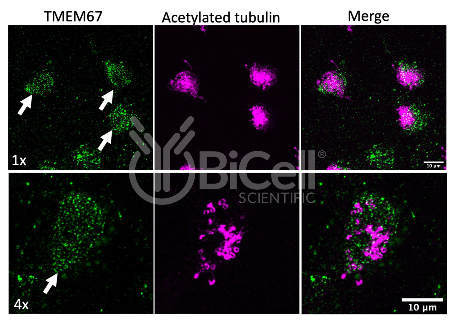 MKS3 (NPHP11 or Meckelin or TMEM67) (Xenopus) Antibody - Western Blot Validated
