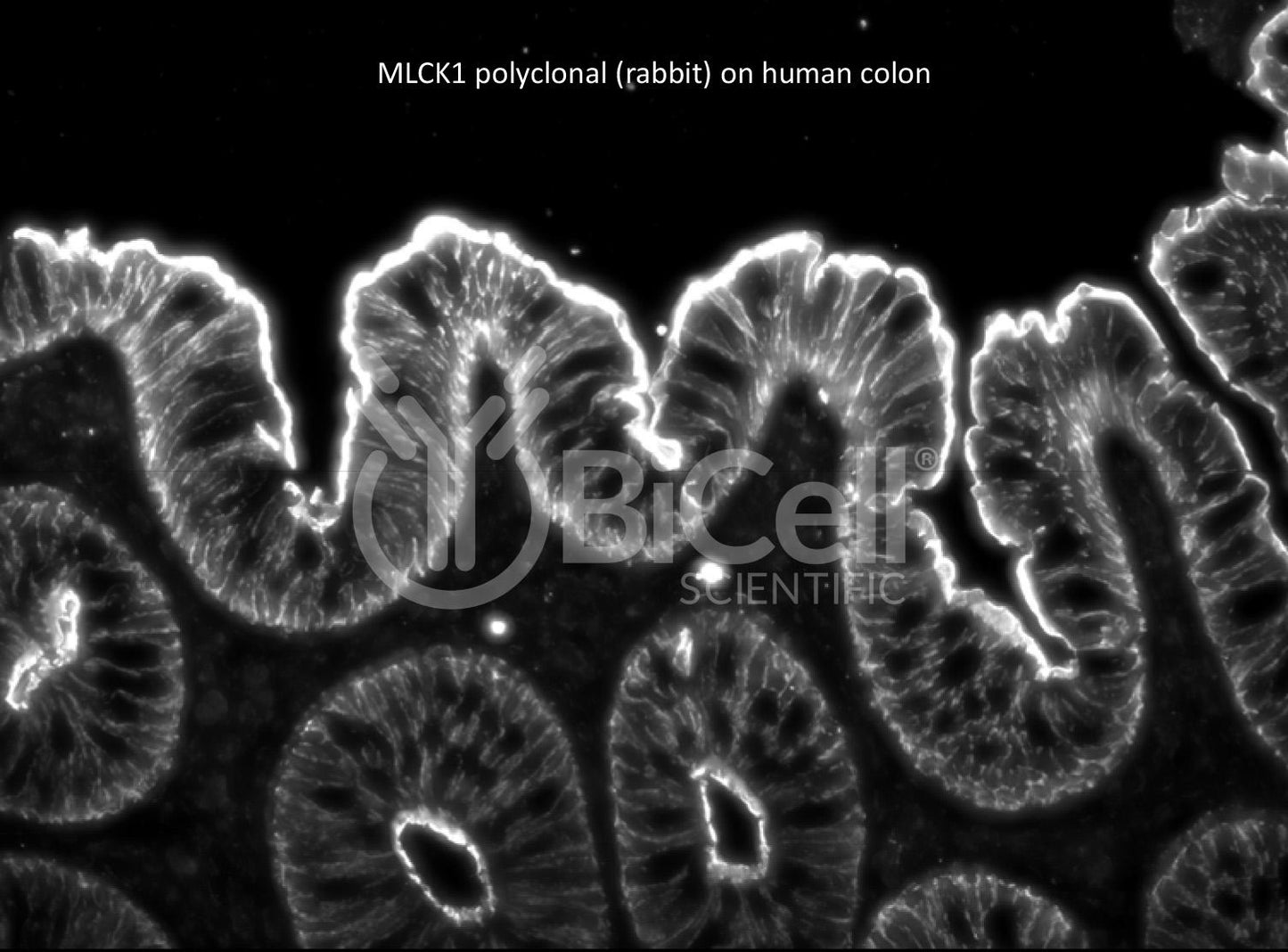 MYLK (MLCK or MLCK1) HiRe rabbit Antibody - FFPE Validated