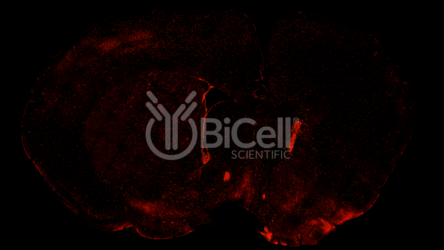 CHRNA2 Antibody - Western Blot Validated
