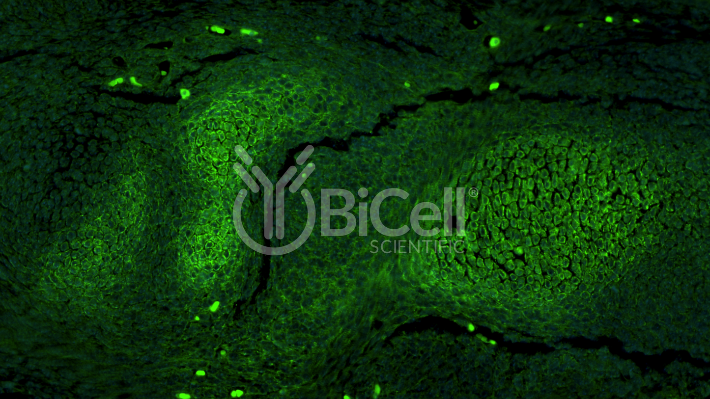 AKT (AKT1 or RAC or PKB) Antibody