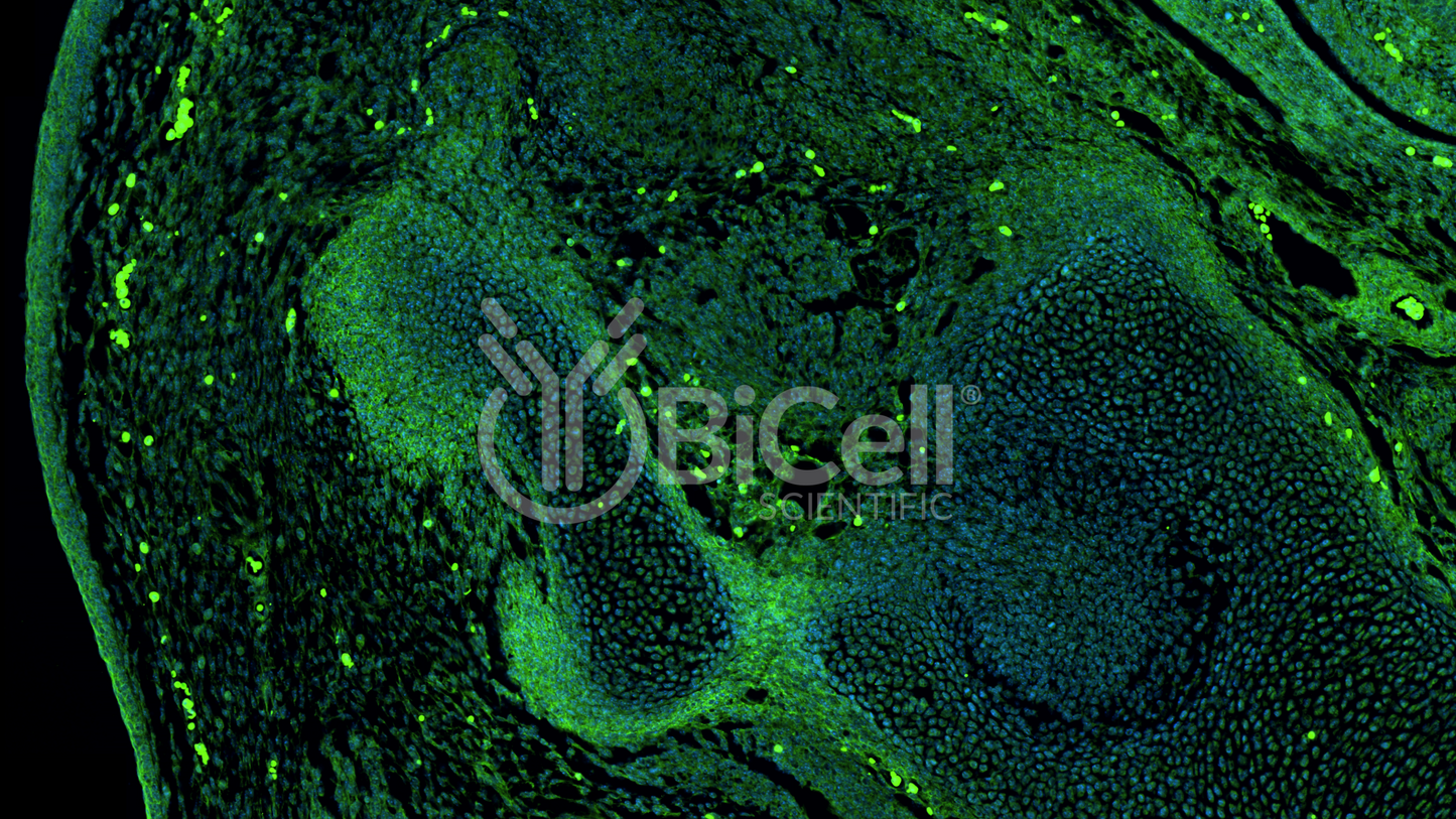 EGFR (ErbB1 or HER1) Antibody
