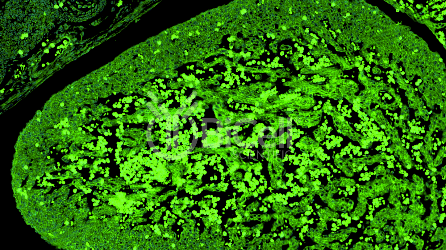 Syncoilin (SYNC) Antibody