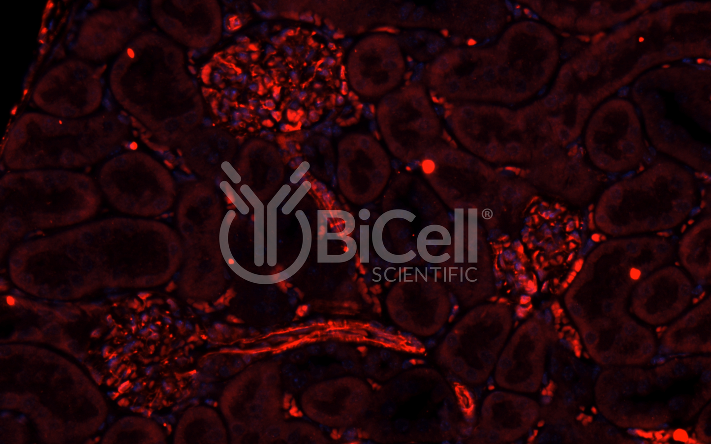 Integrin alpha-1 (ITGA1 or CD49a) Antibody - Western Blot Validated