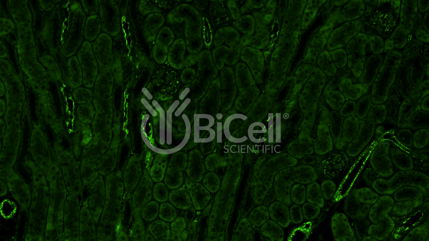 Integrin alpha-L (ITGAL or CD11a) Antibody - FFPE Validated