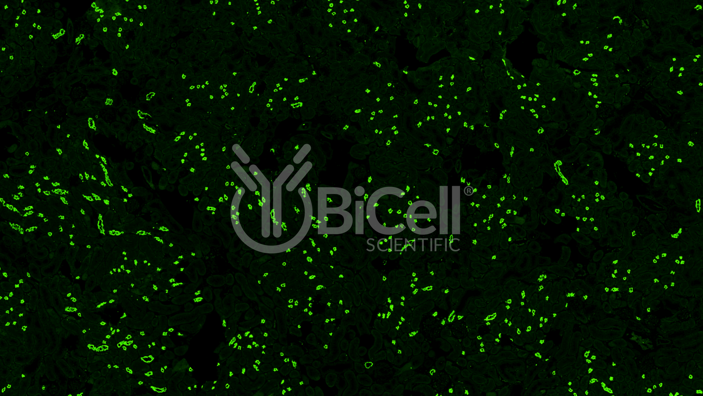 NKCC2 (Slc12a1) Antibody - FFPE Validated