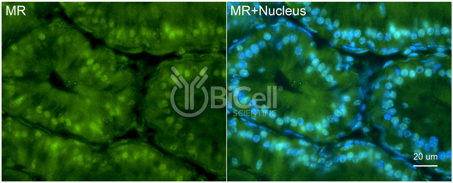 MR (NR3C2) Antibody