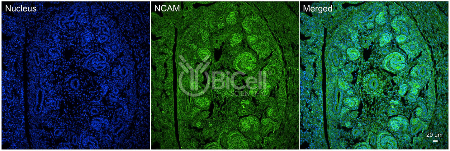 NCAM (CD56) Antibody - FFPE Validated