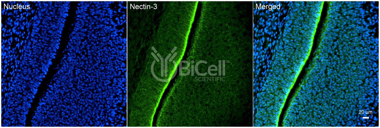 Nectin-3 (CD113) Antibody - FFPE Validated