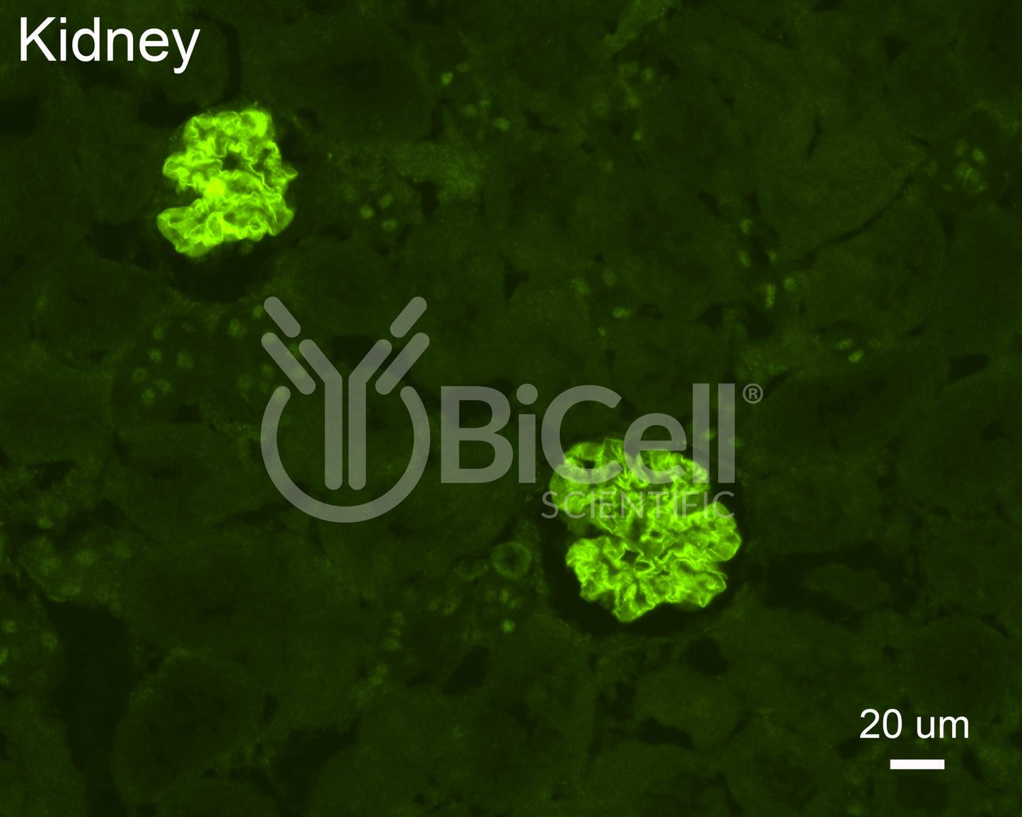 NEPH2 (KIRREL3) Antibody - FFPE Validated