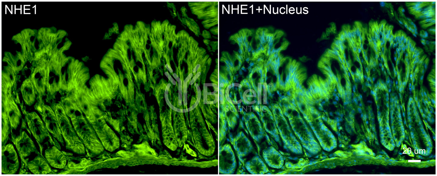 NHE1 (Slc9a1) Antibody - FFPE Validated