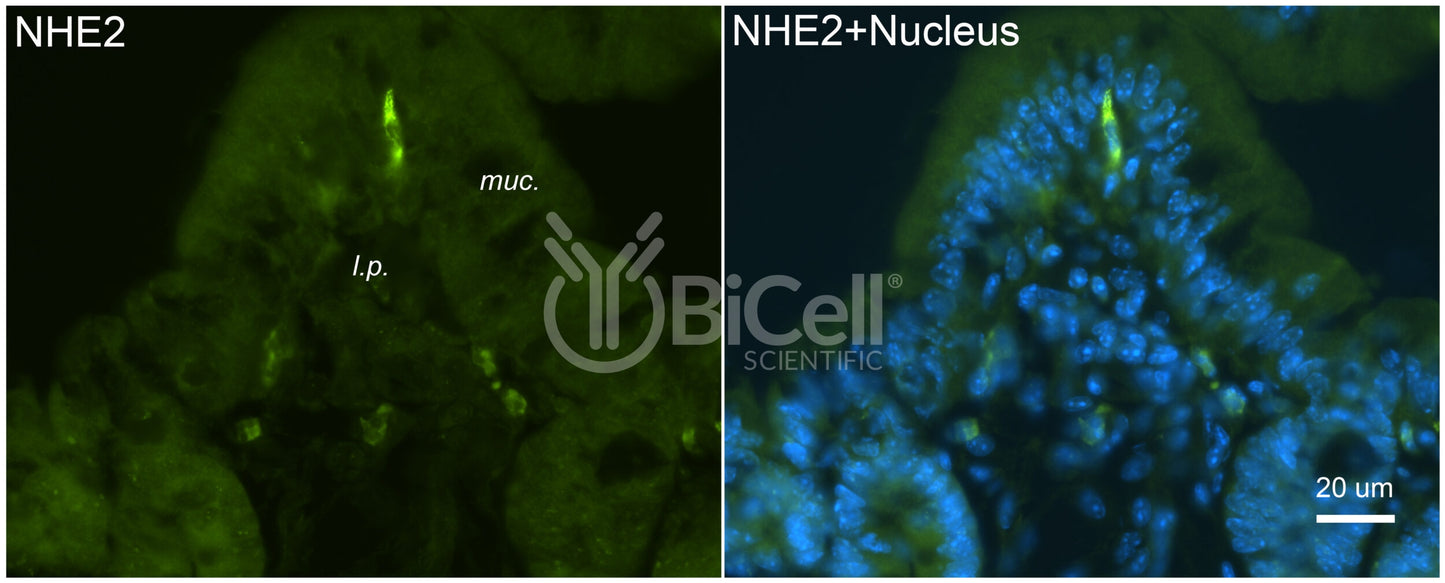 NHE2 (Slc9a2) Antibody - Western Blot Validated