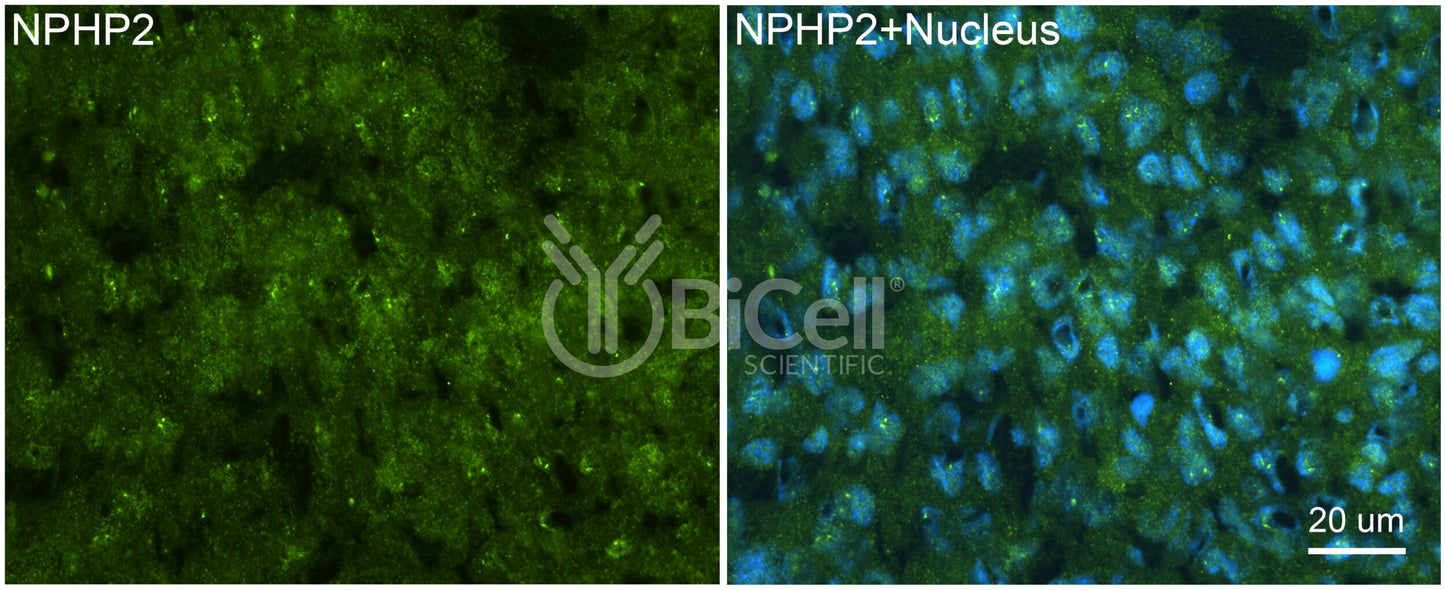 Nephrocystin-2 (NPHP2 or Inversin or INVS) Antibody