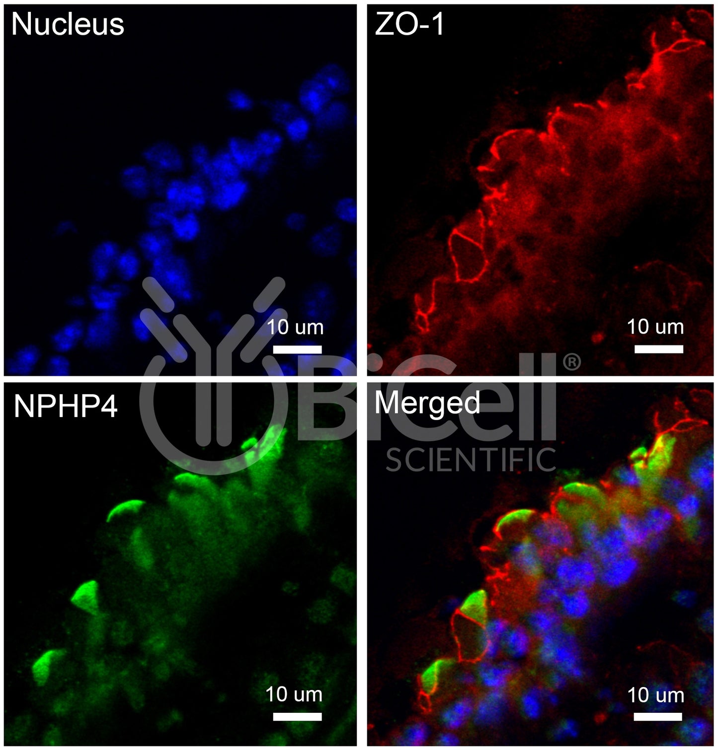 Nephrocystin-4 (NPHP4) Antibody - FFPE Validated