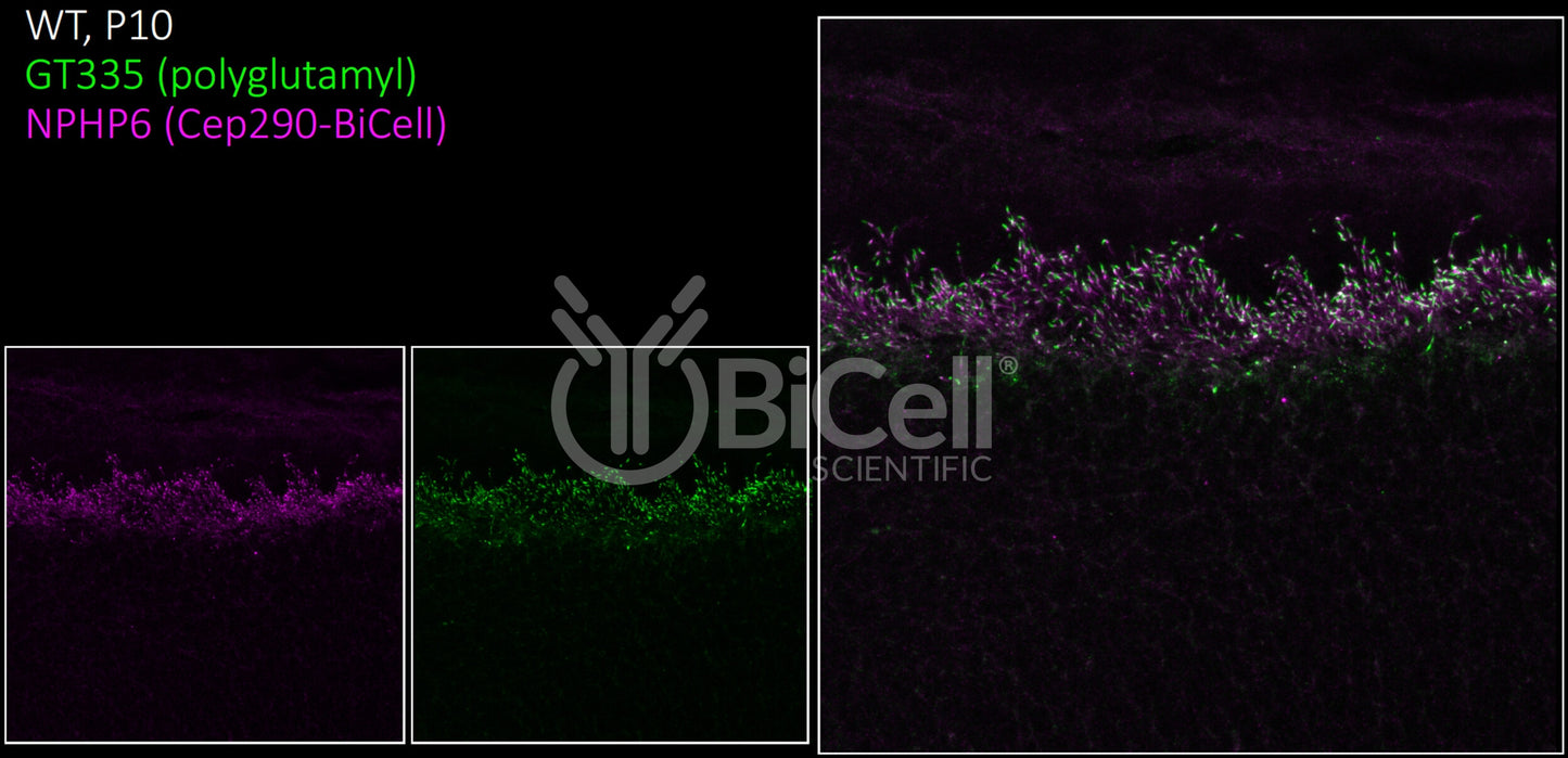 Nephrocystin-6 (NPHP6 or CEP290 or MKS4 or BBS14) Antibody - FFPE Validated