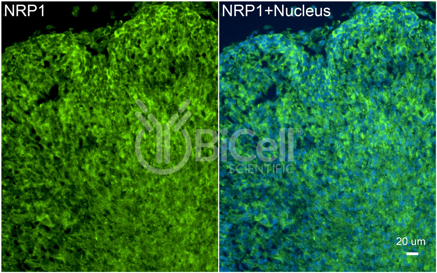 Neuropilin-1 (NRP1) Antibody
