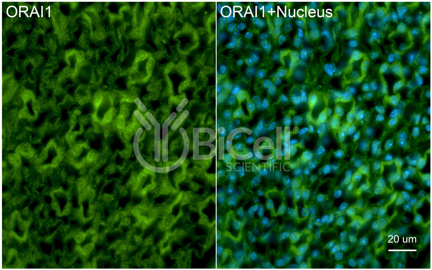 ORAI1 (TAM2 or TMEM142A) Antibody