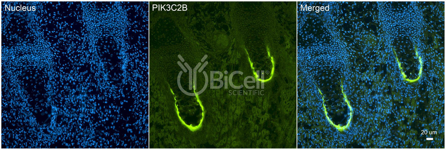 PIK3C2B (C2-PI3K) Antibody - Western Blot Validated
