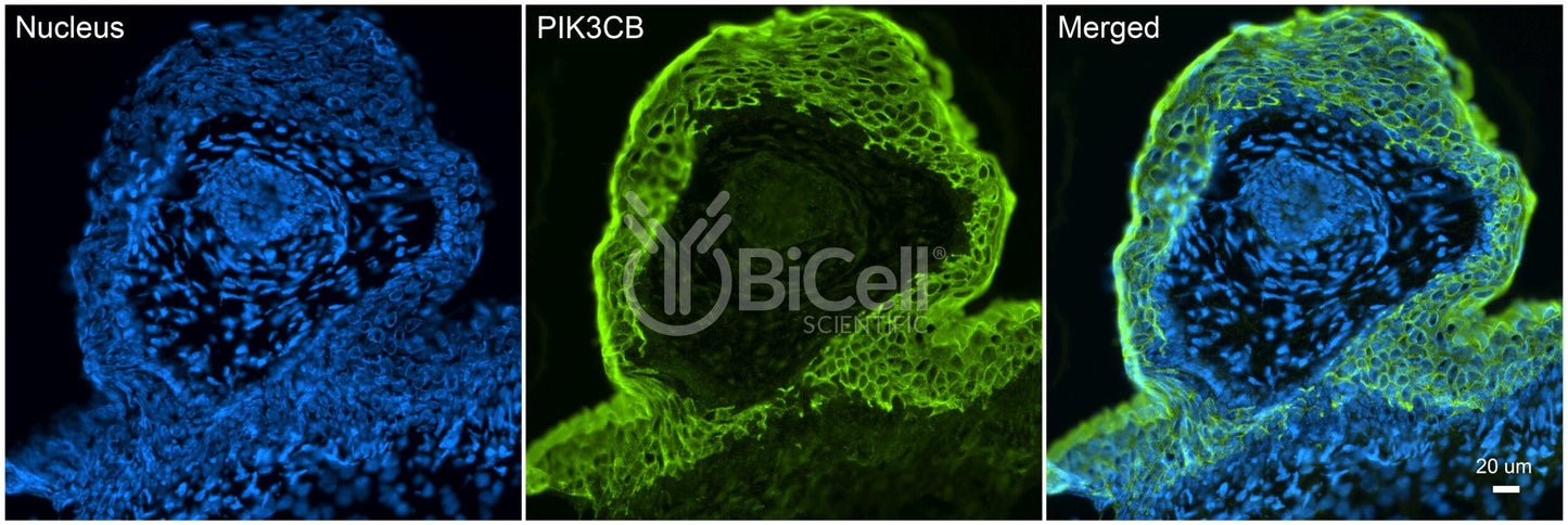 PIK3CB (PI3K-beta or p110-beta) Antibody - Western Blot Validated