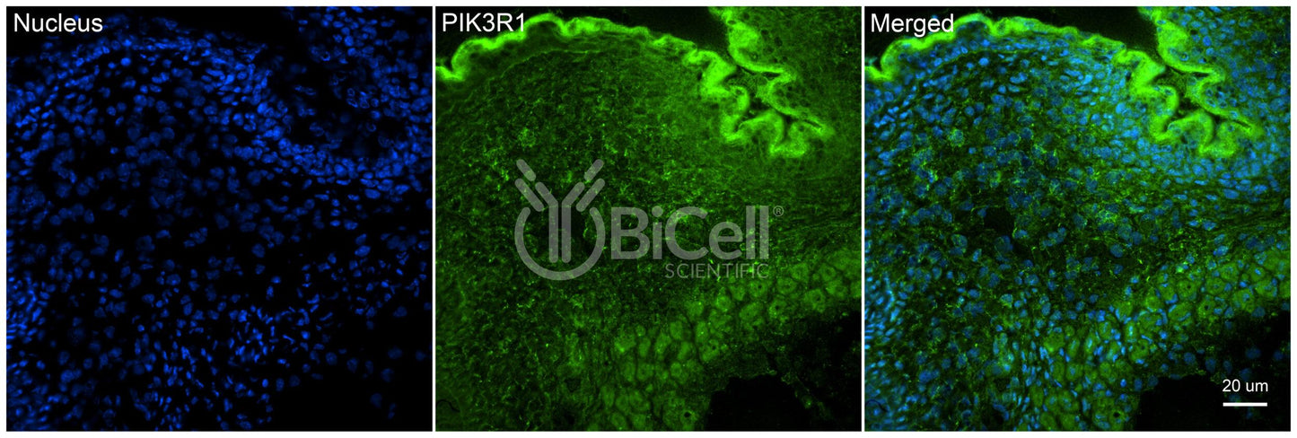 PIK3R1 (p85 or p85alpha) Antibody