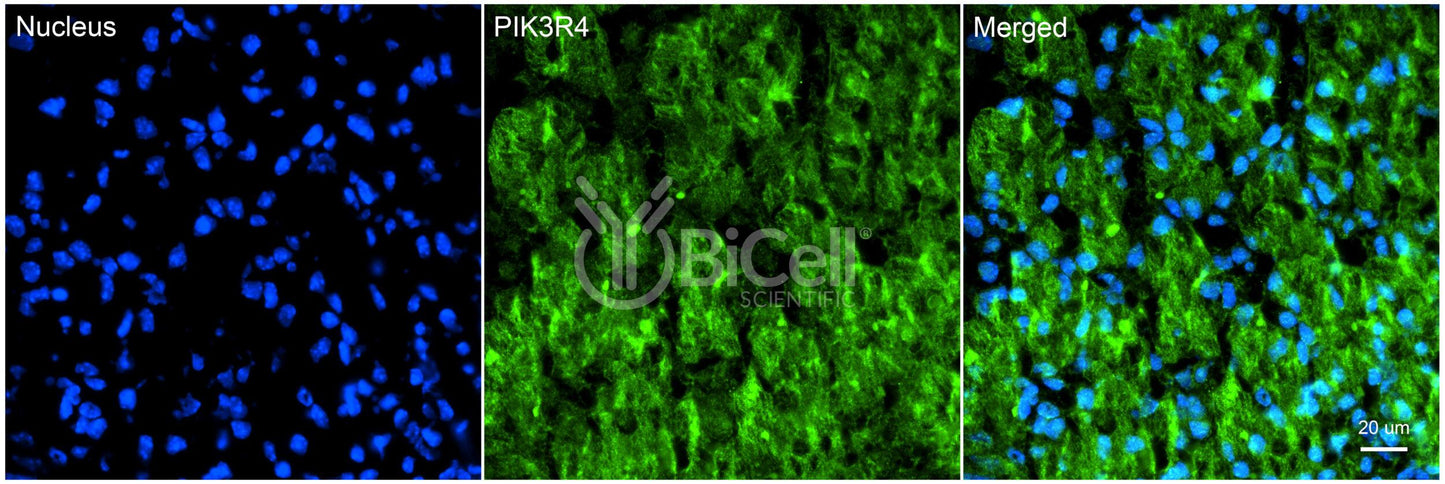 PIK3R4 (p150) Antibody - FFPE Validated