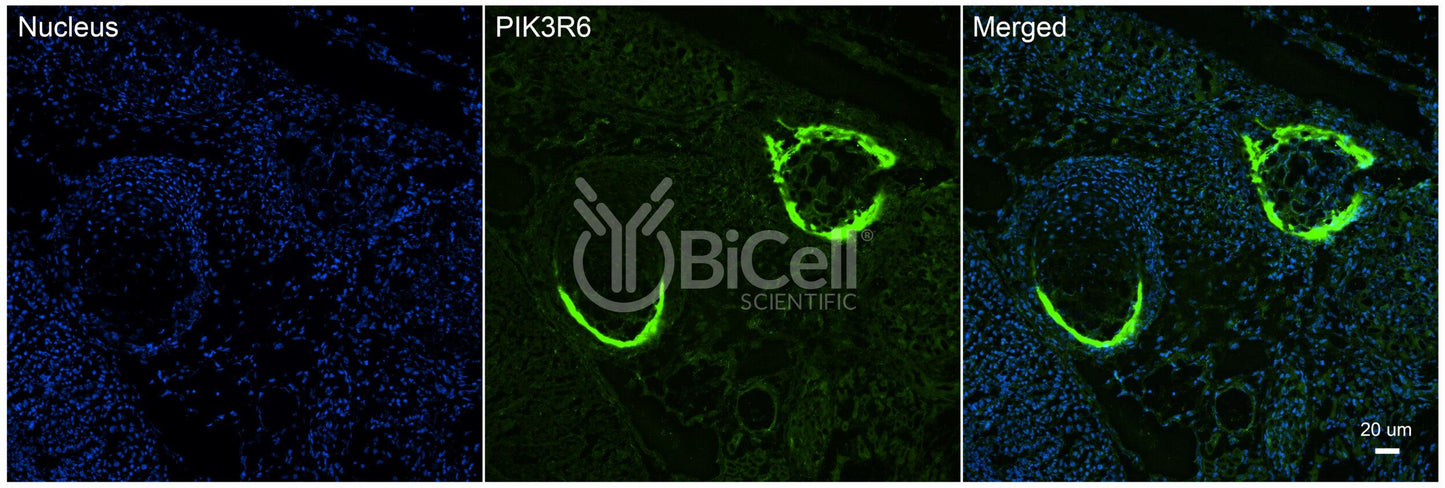 PIK3R6 (p87PIKAP) Antibody - Western Blot Validated
