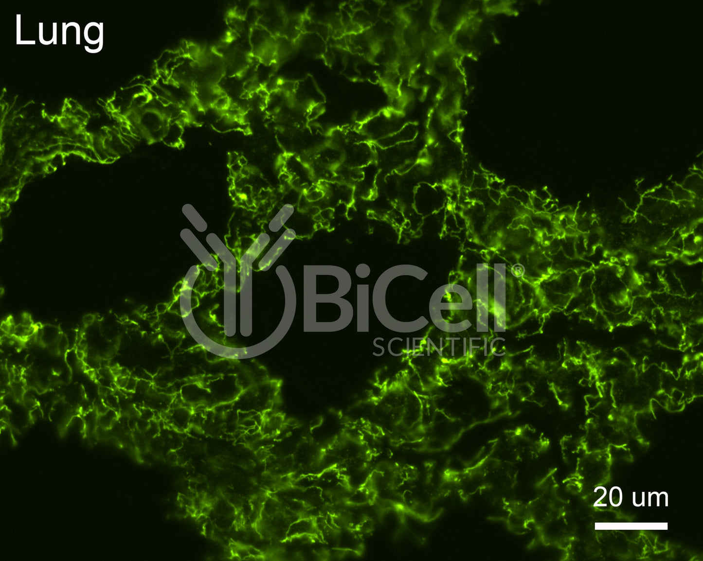 PALS1 (MPP5) Antibody - Western Blot Validated