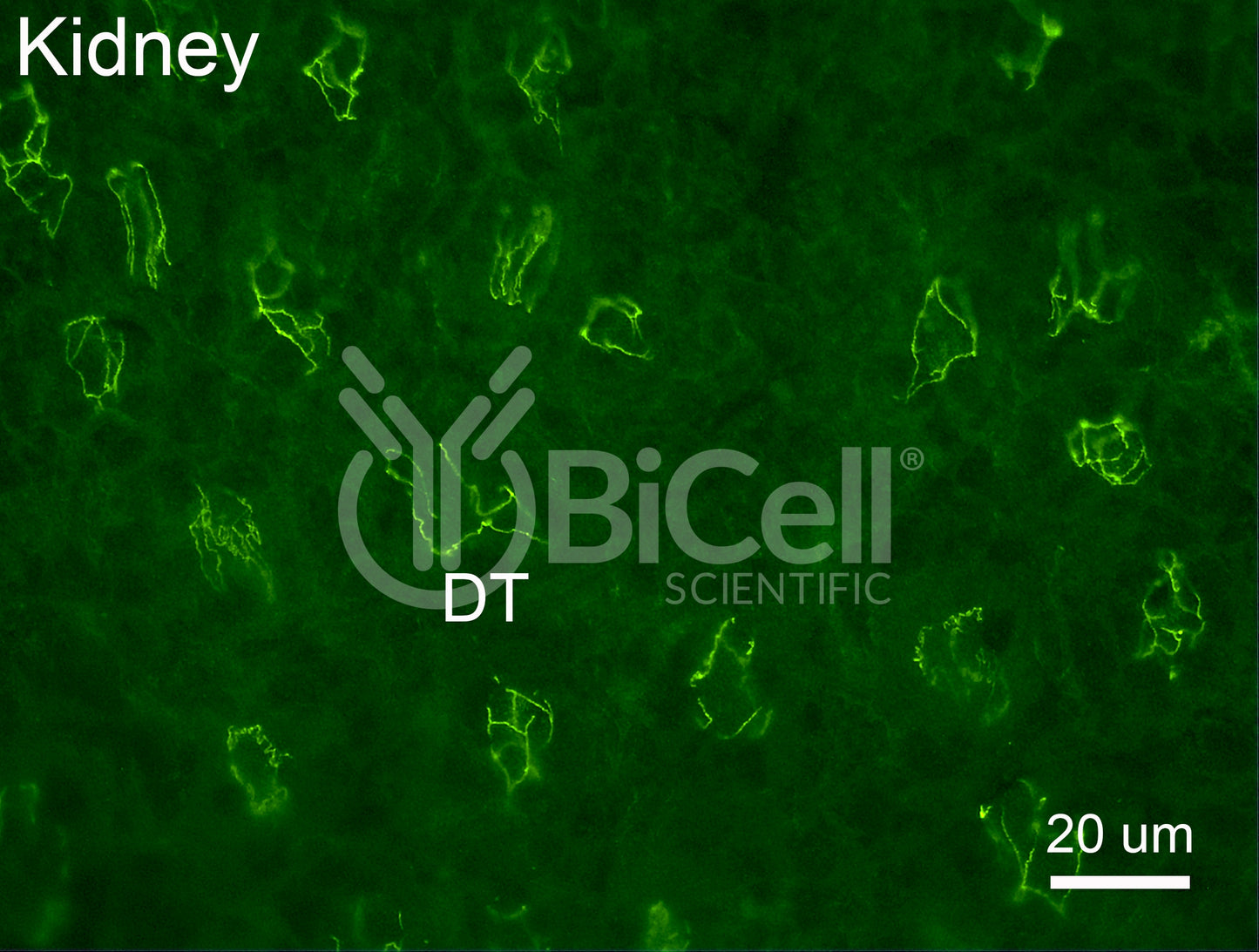 PATJ Antibody - FFPE Validated