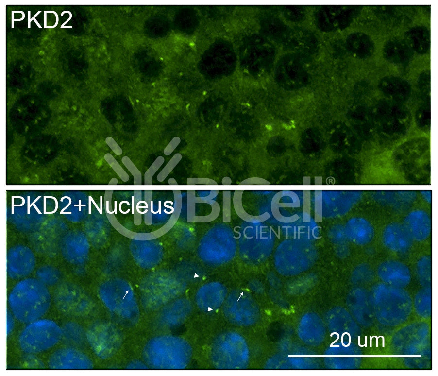 Polycystin-2 (PKD2) Antibody - Western Blot Validated