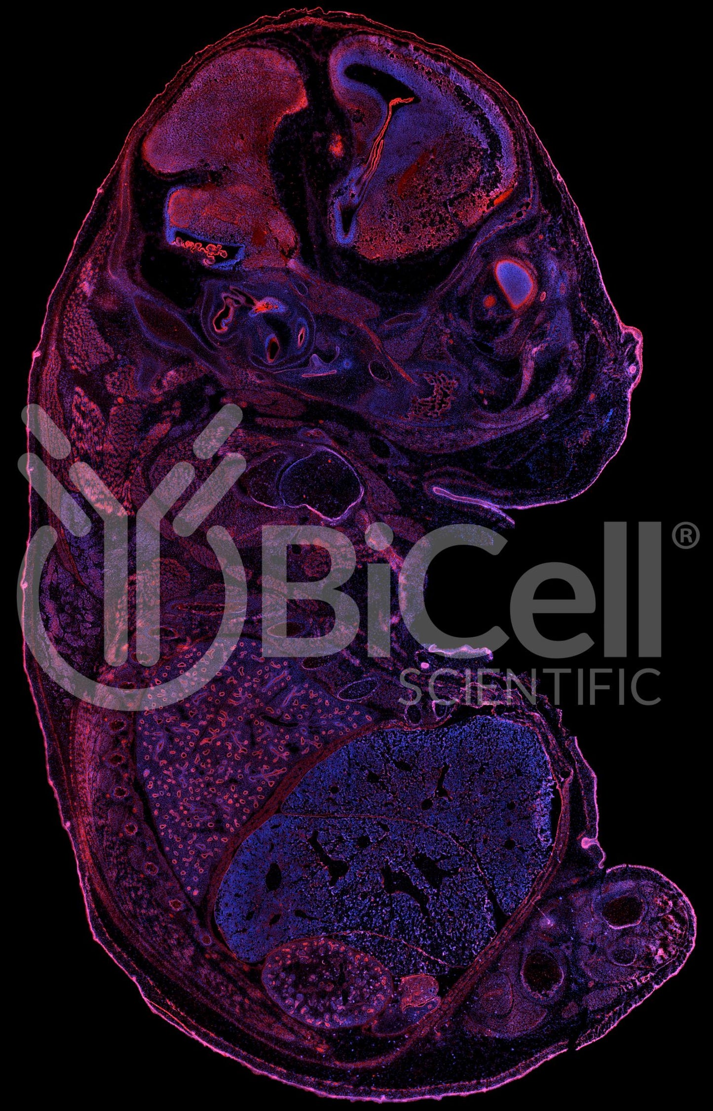 P-Cadherin (Cadherin-3 or CDH3) Antibody - FFPE Validated