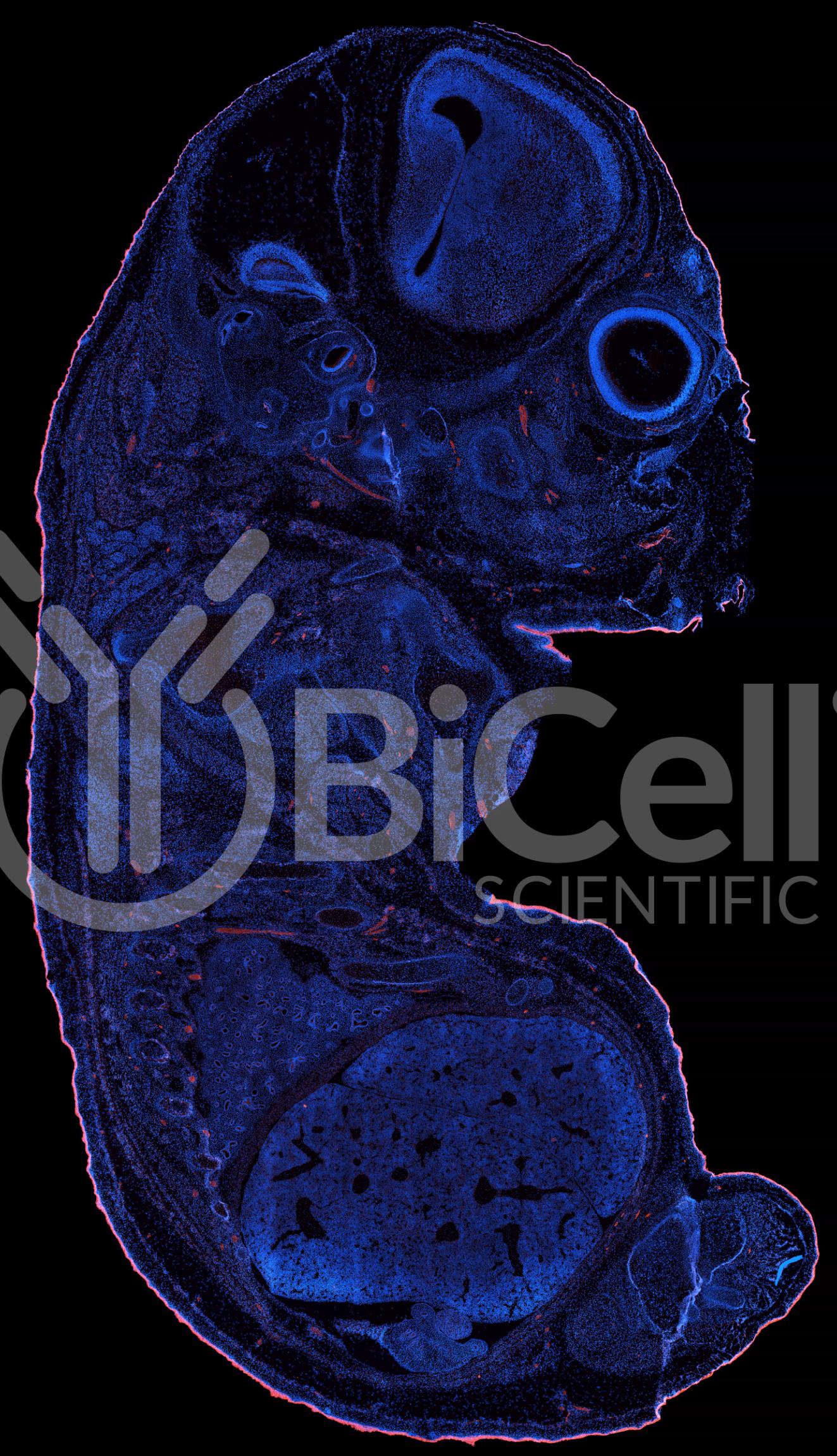 Protocadherin-15 (PCDH15 or CDHR15 or USH1F or DFNB23) Antibody - Western Blot Validated