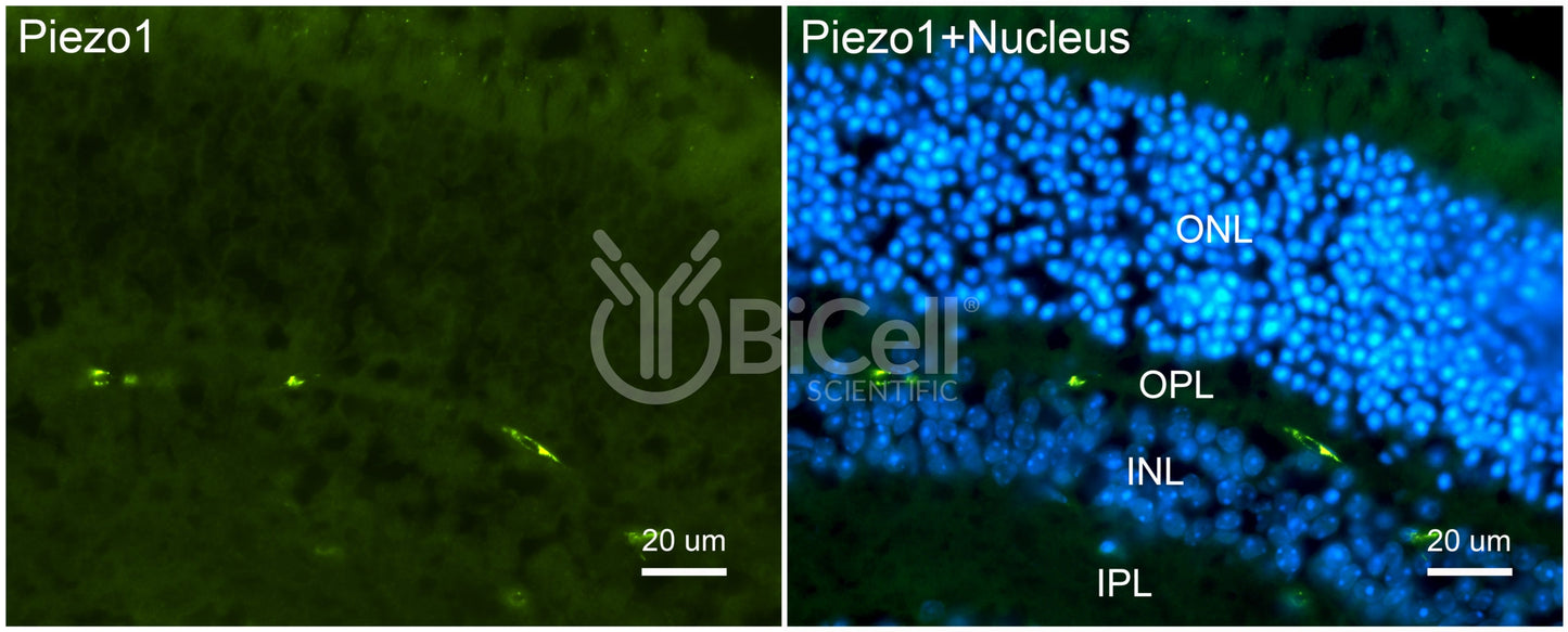 Piezo1 (Internal) Antibody - Western Blot Validated