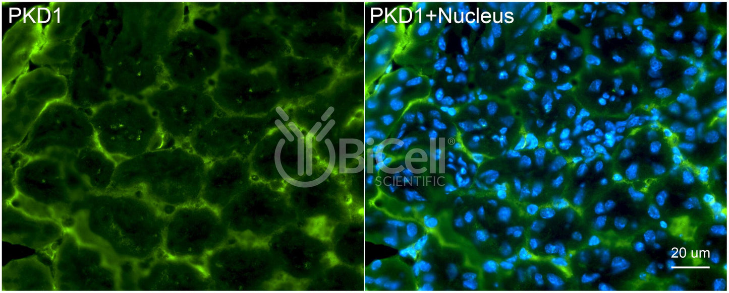 Polycystin-1 (PKD1) Monoclonal Antibody (B2 Clone) - FFPE Validated