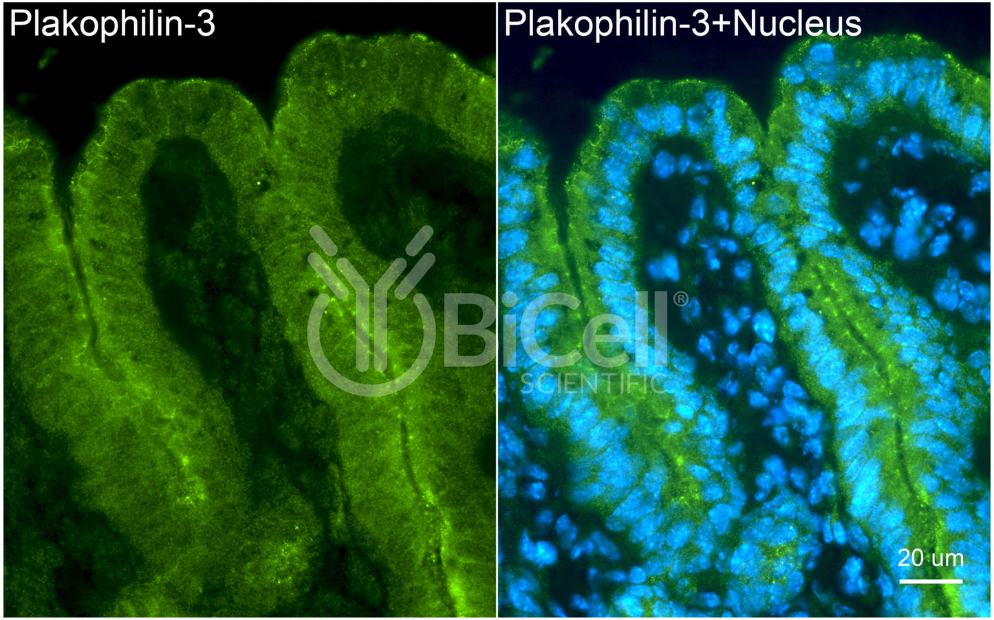 Plakophilin-3 (PKP3) Antibody - FFPE Validated