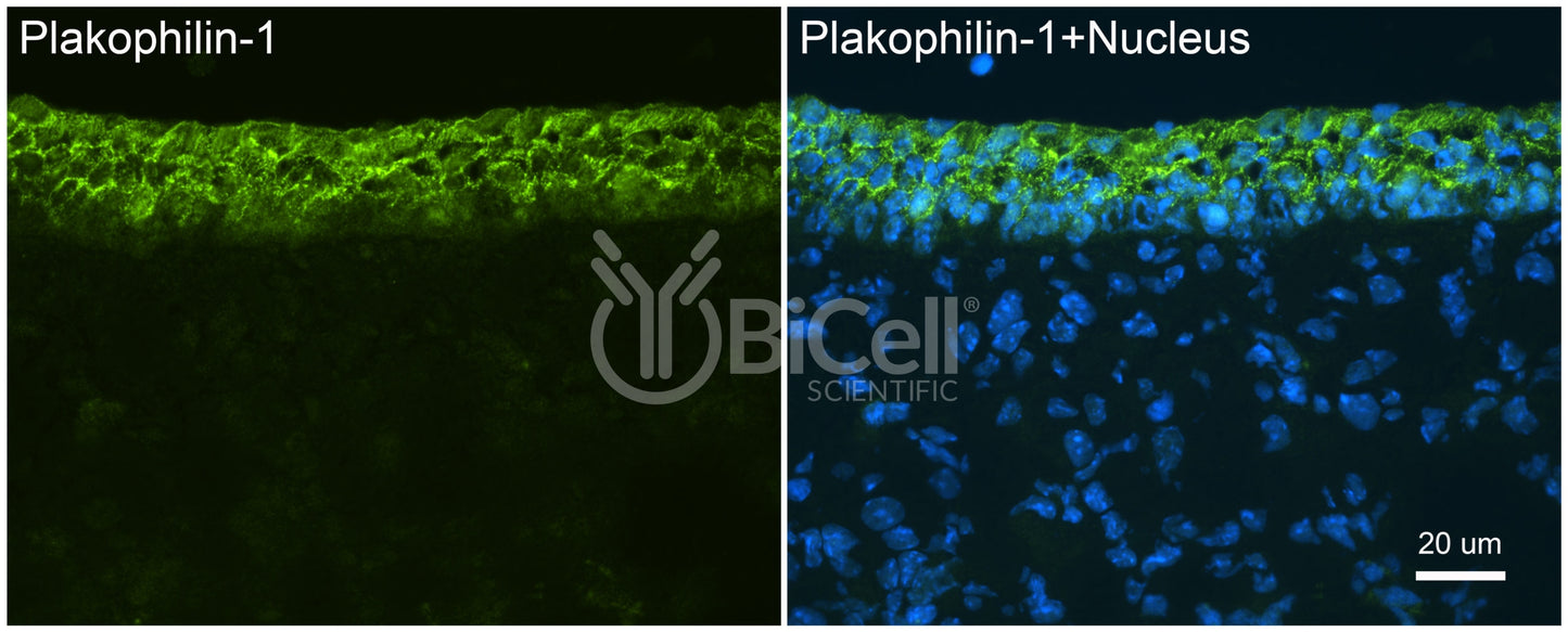 Plakophilin-1 (PKP1) Antibody