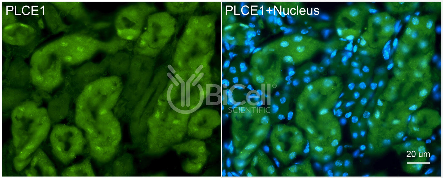 PLCE1 (PLCE) Antibody - FFPE Validated