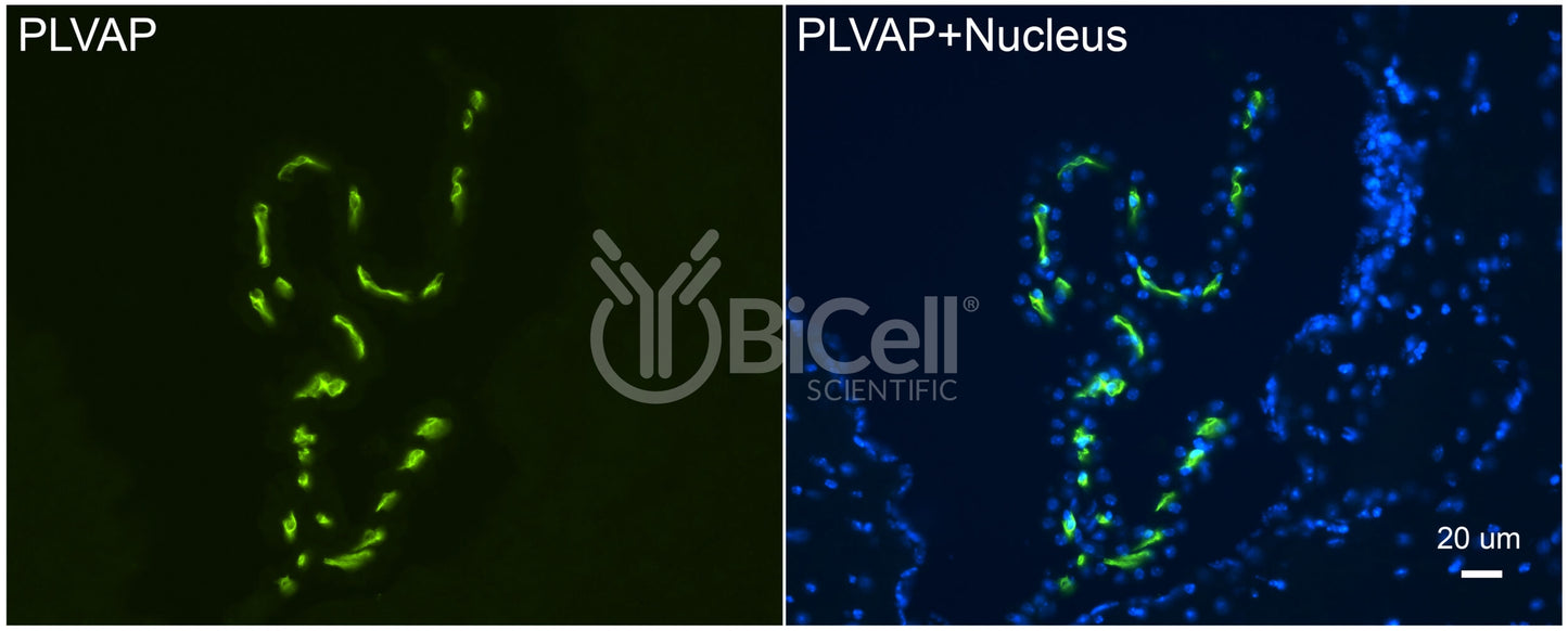 PLVAP (PV1) Antibody - FFPE Validated