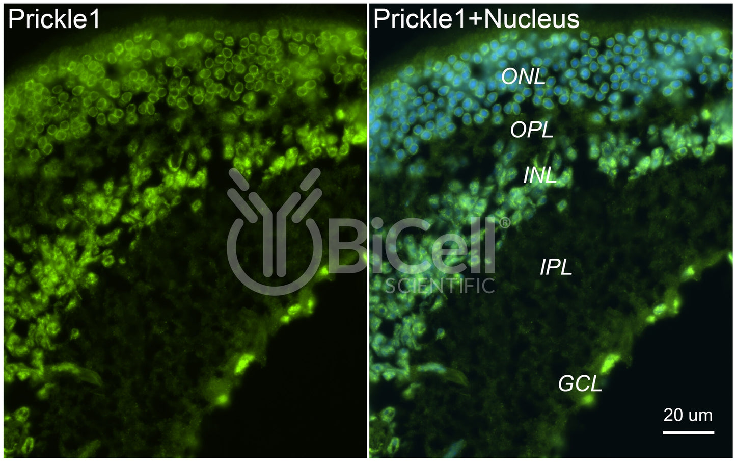 PRICKLE1 (RILP) Antibody