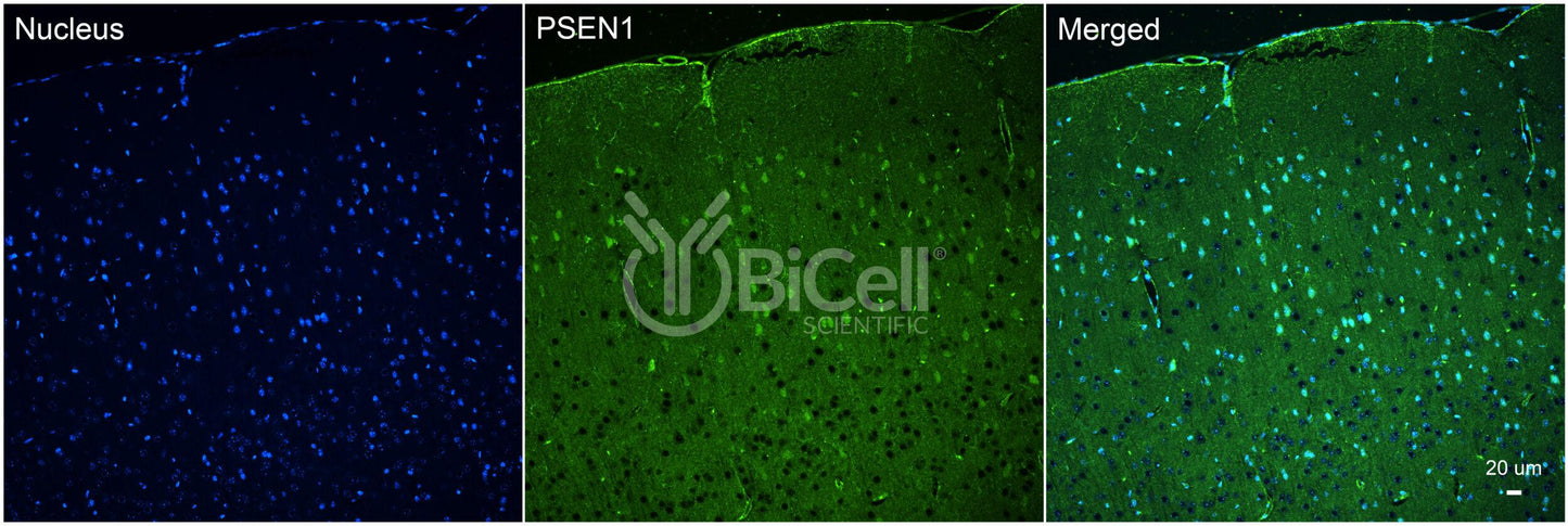 Presenilin-1 (PSEN1 or PS1 or AD3) Antibody - Western Blot Validated