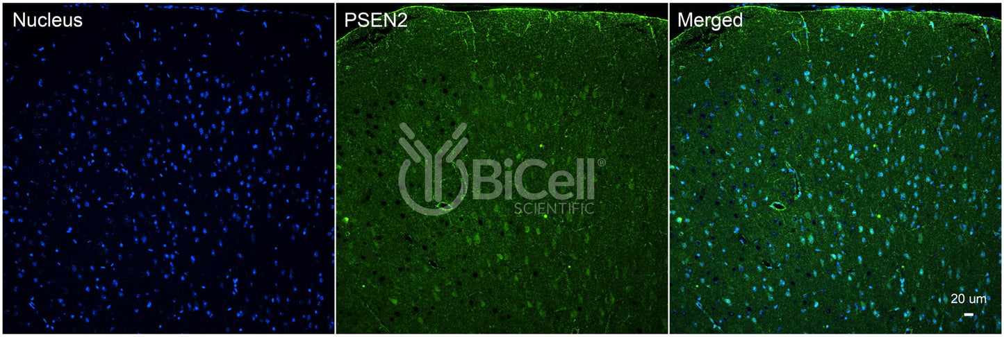Presenilin-2 (PSEN2 or PS2 or AD4) Antibody - Western Blot Validated