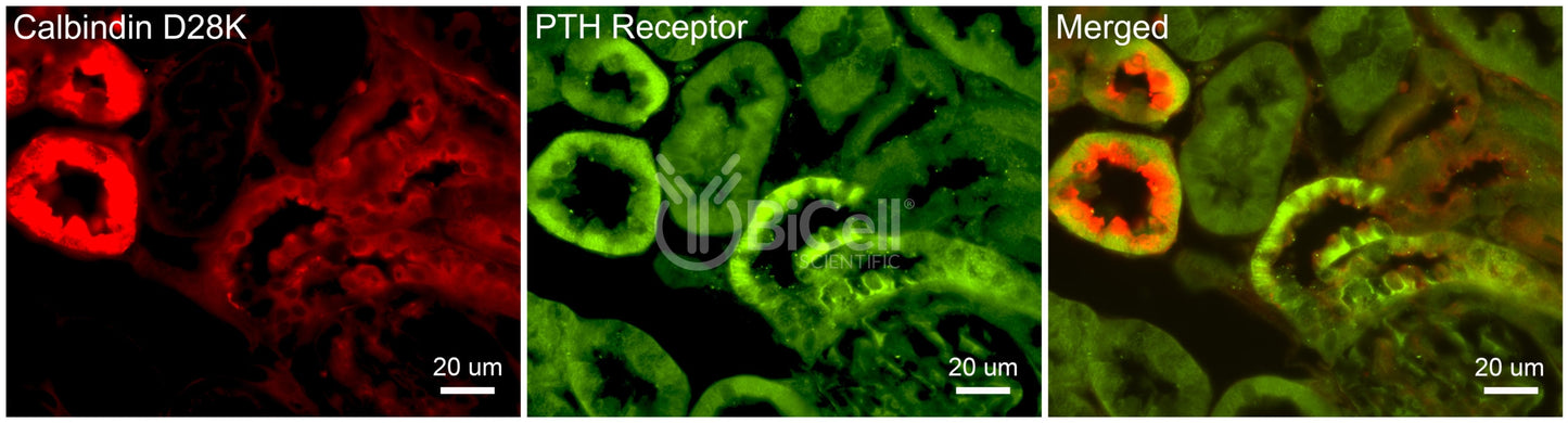 PTH1R Antibody - Western Blot Validated